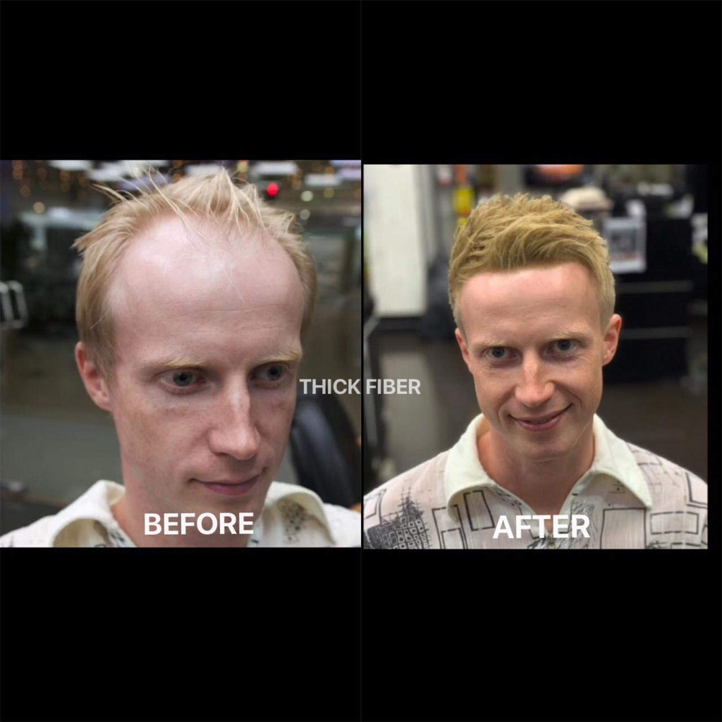 THICK FIBER Hair Fibers for Thinning Hair & Bald Spots – Medium Blonde (25g) | Conceal Hair Loss
