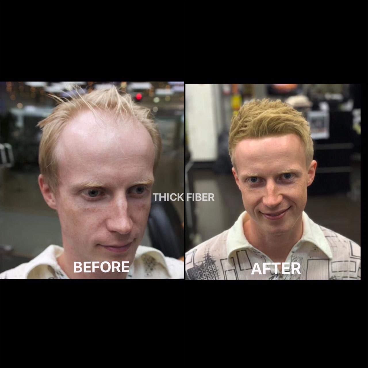 THICK FIBER Hair Fibers for Thinning Hair & Bald Spots – Medium Blonde (25g) | Conceal Hair Loss