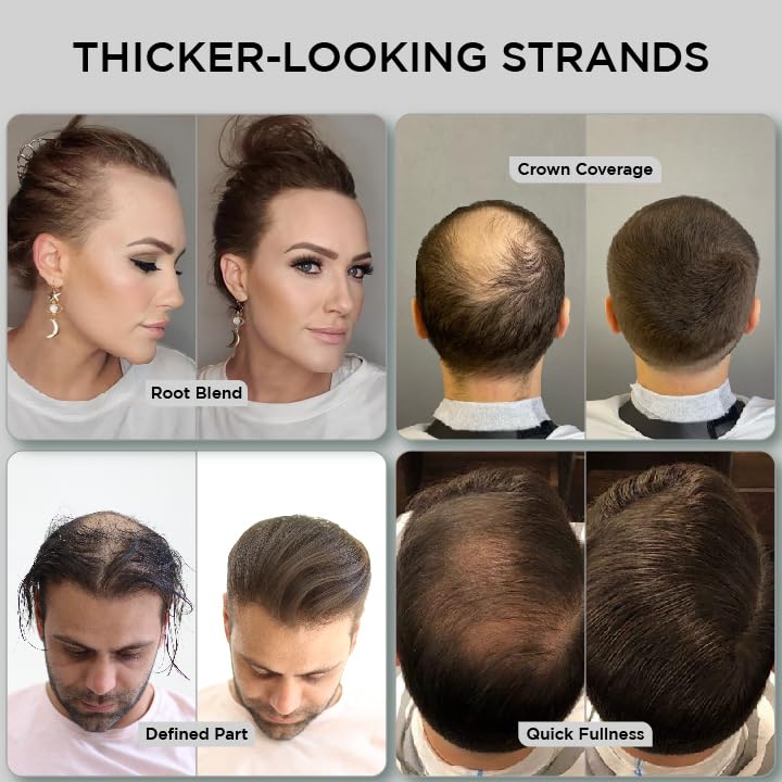 THICK FIBER Hair Fibers for Thinning Hair & Bald Spots (Dark Brown, Pack of 3) – 25g Bottle