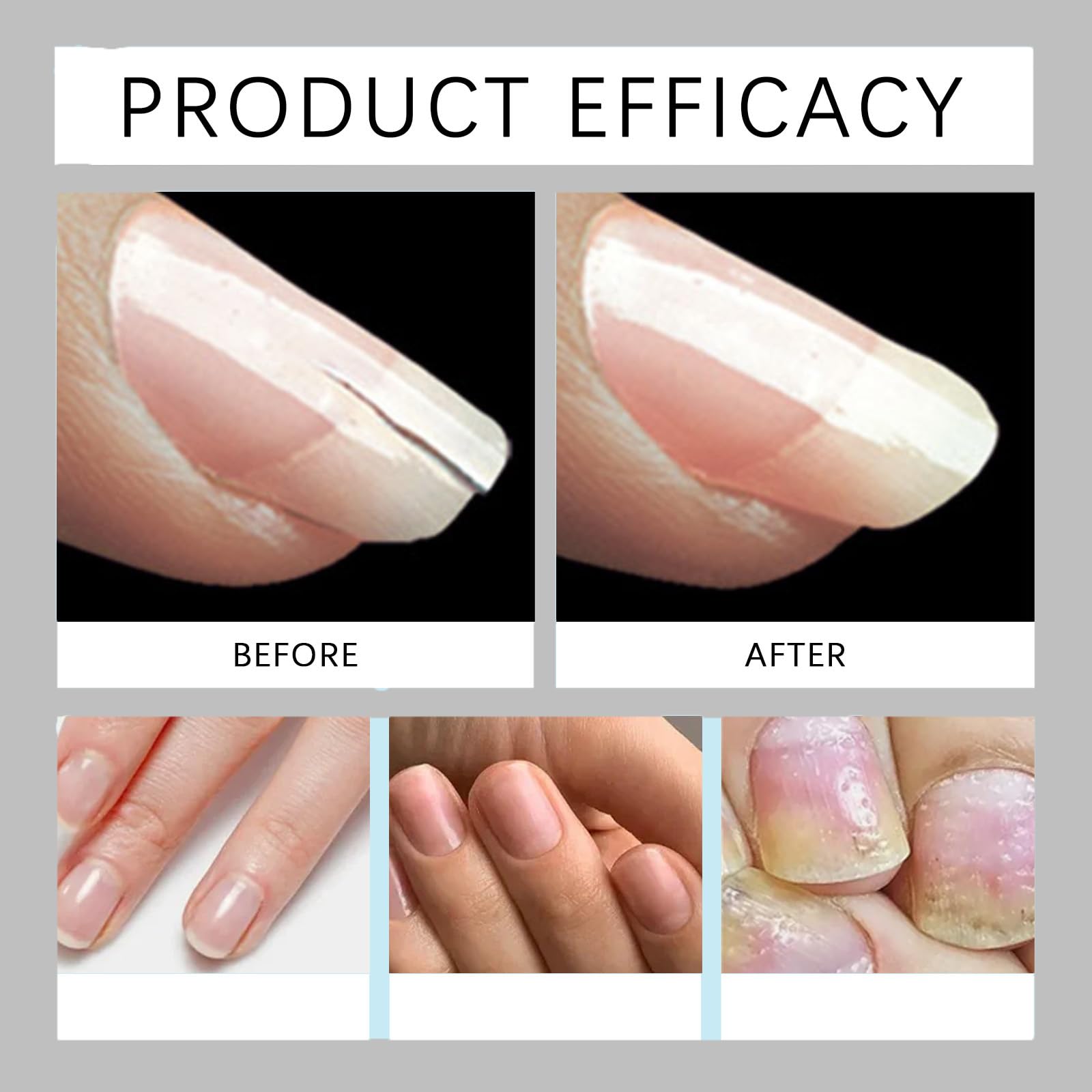 Tiliraiy Nail Growth Pen – Radiant Nail Care with Lemon Tea Tree Cuticle Oil