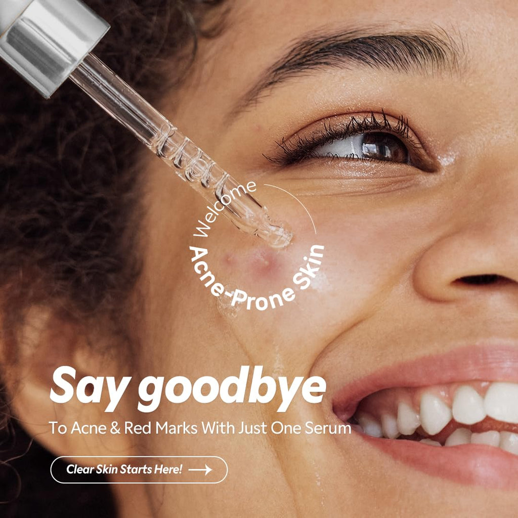 TIRTIR Azelaic Acid 12% Serum – Lightweight Hydration for Blemish-Prone Skin