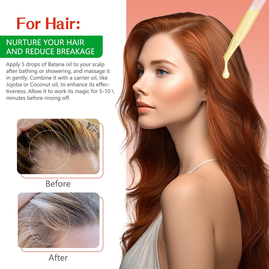 Tiuedu 2-Pack Batana Oil for Hair Growth | Natural Unrefined Hair Oil