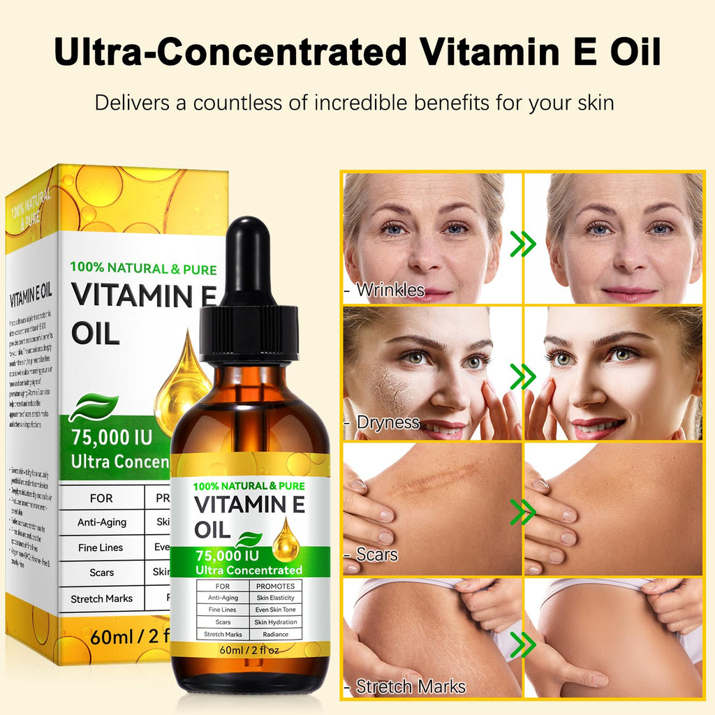 Tiuedu 2PCS Natural Vitamin E Oil – 75,000 IU Ultra Concentrated for Skin, Face, Hair & Scars