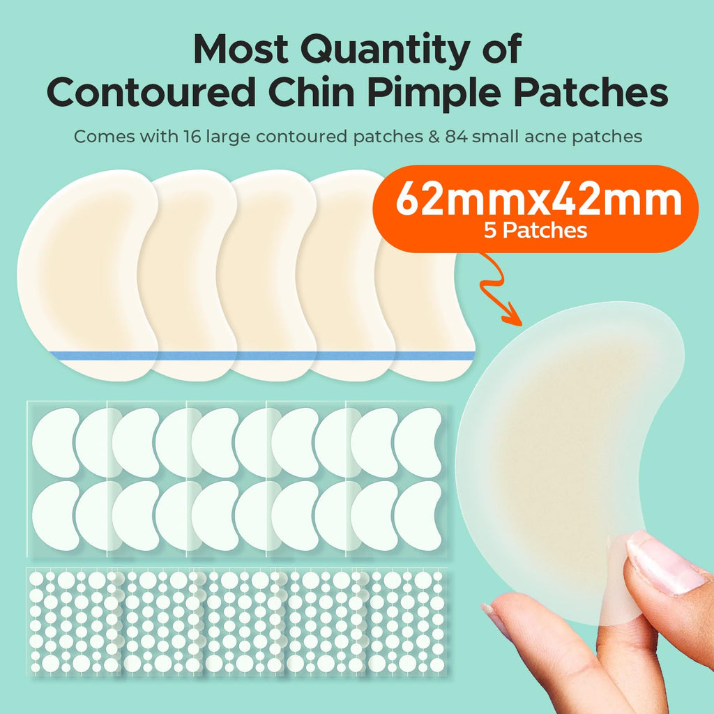 TKTK Chin Pimple Patches — 265 Count, 6 Sizes, XL Contoured 62x42 mm and L 38x26 mm
