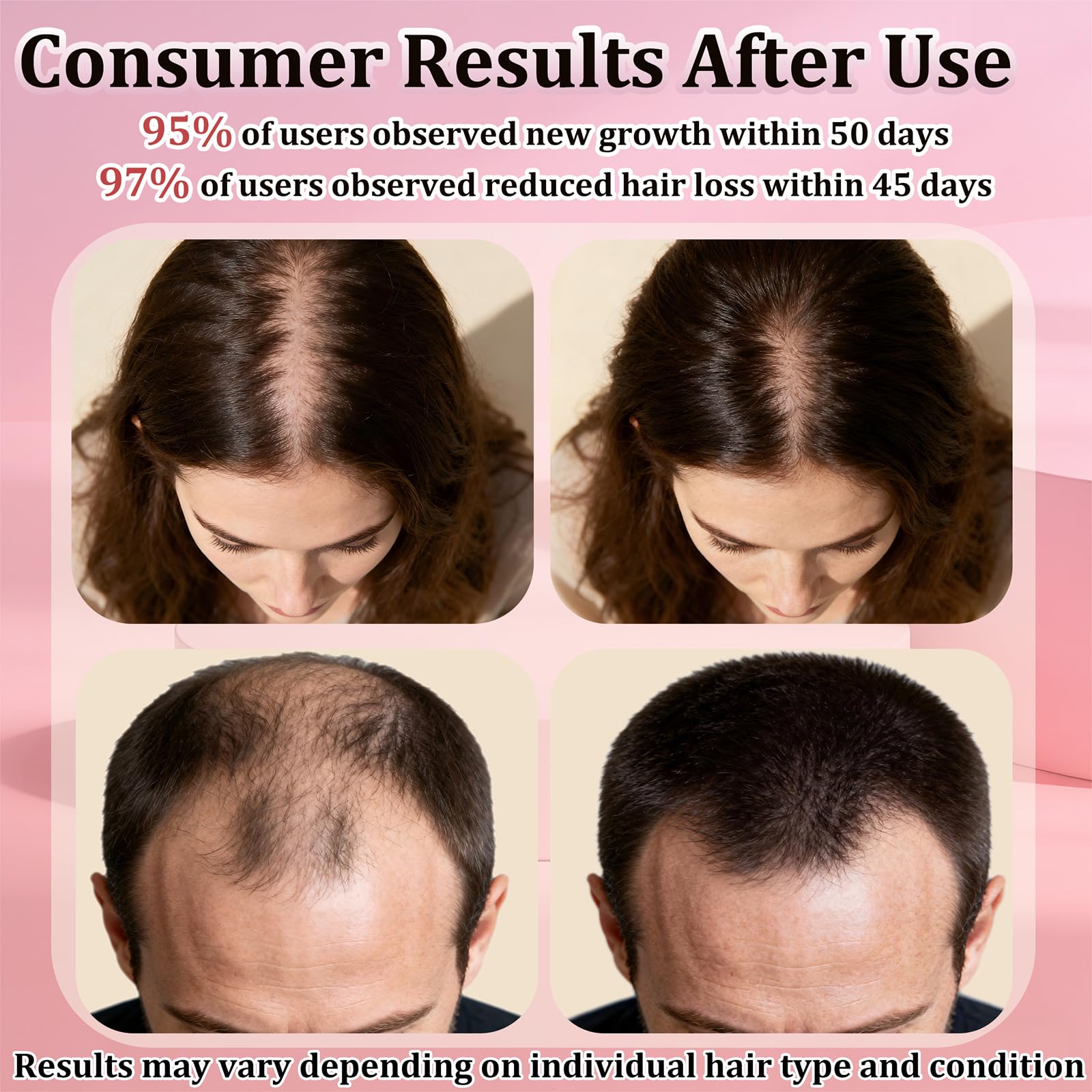 Topical 5% Minoxidil Spray for Hair Regrowth – TNEGHC (9-Month Supply, 5 x 3.38 oz)