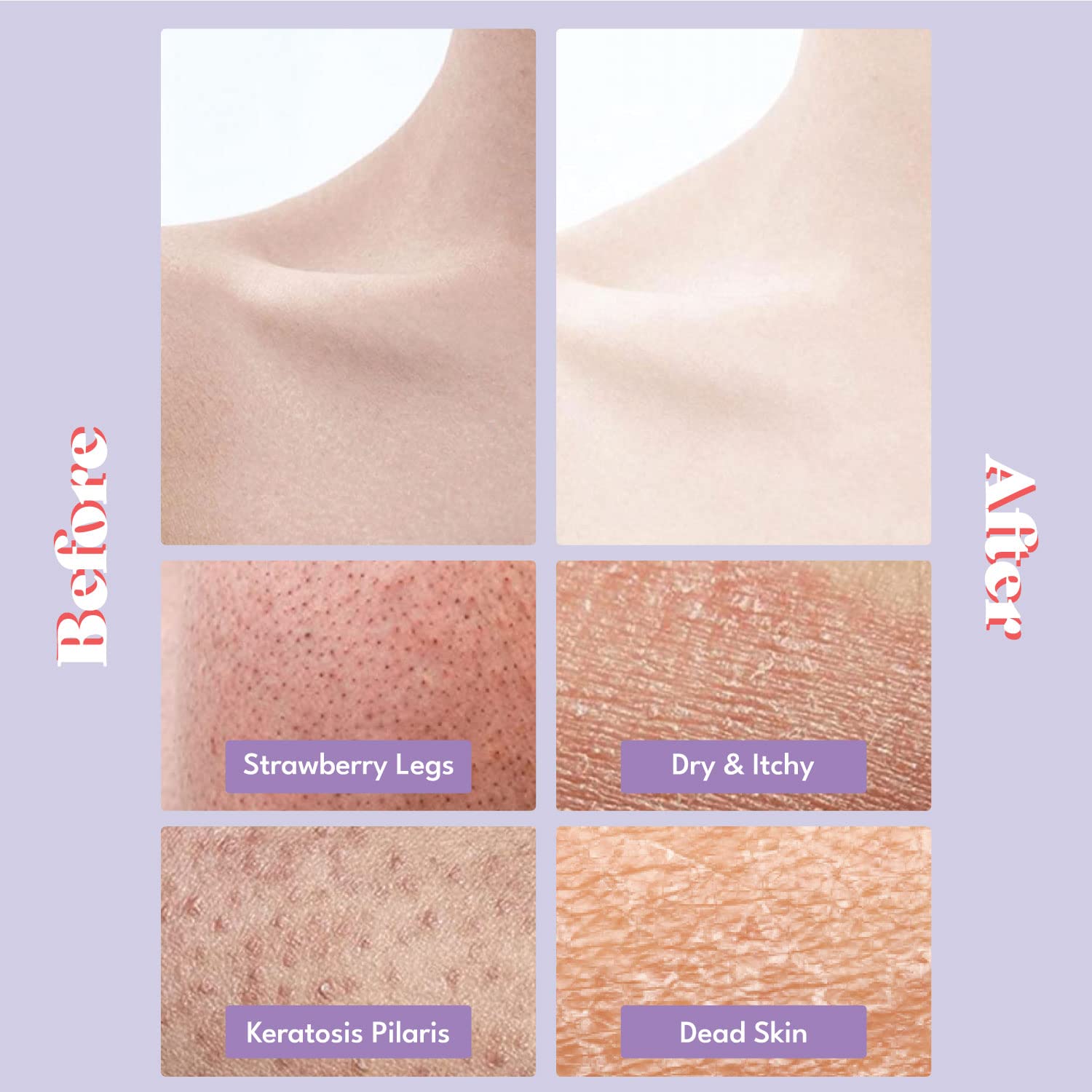 TOI:L Gentle Touch Bubble Peeling Pad – Dual Sided Body Exfoliator for Home Spa