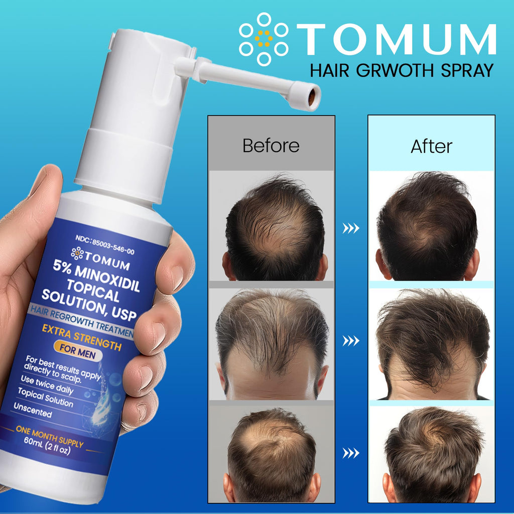 Tomum Men's 5% Minoxidil Hair Growth Spray – Extra Strength, 60ml, Made in USA