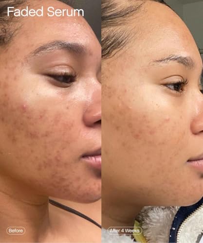 Topicals Faded Brightening & Clearing Serum | Kojic Acid + Niacinamide | Dermatologist-Tested, Vegan