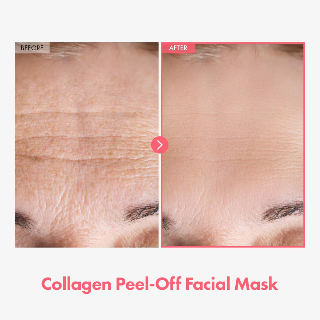 TOSOWOONG Real Collagen Fit Peel-Off Mask – Hydration, Glow, 2-Pack