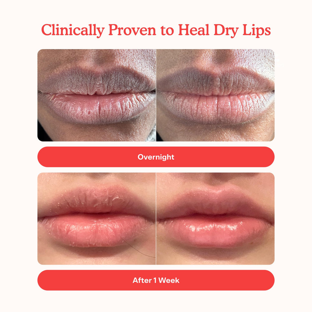 Tower 28 LipSoftie Tinted Lip Balm Treatment – Hydrating Glossy Balm & Overnight Mask (Watermelon Kiwi, 0.38 oz)