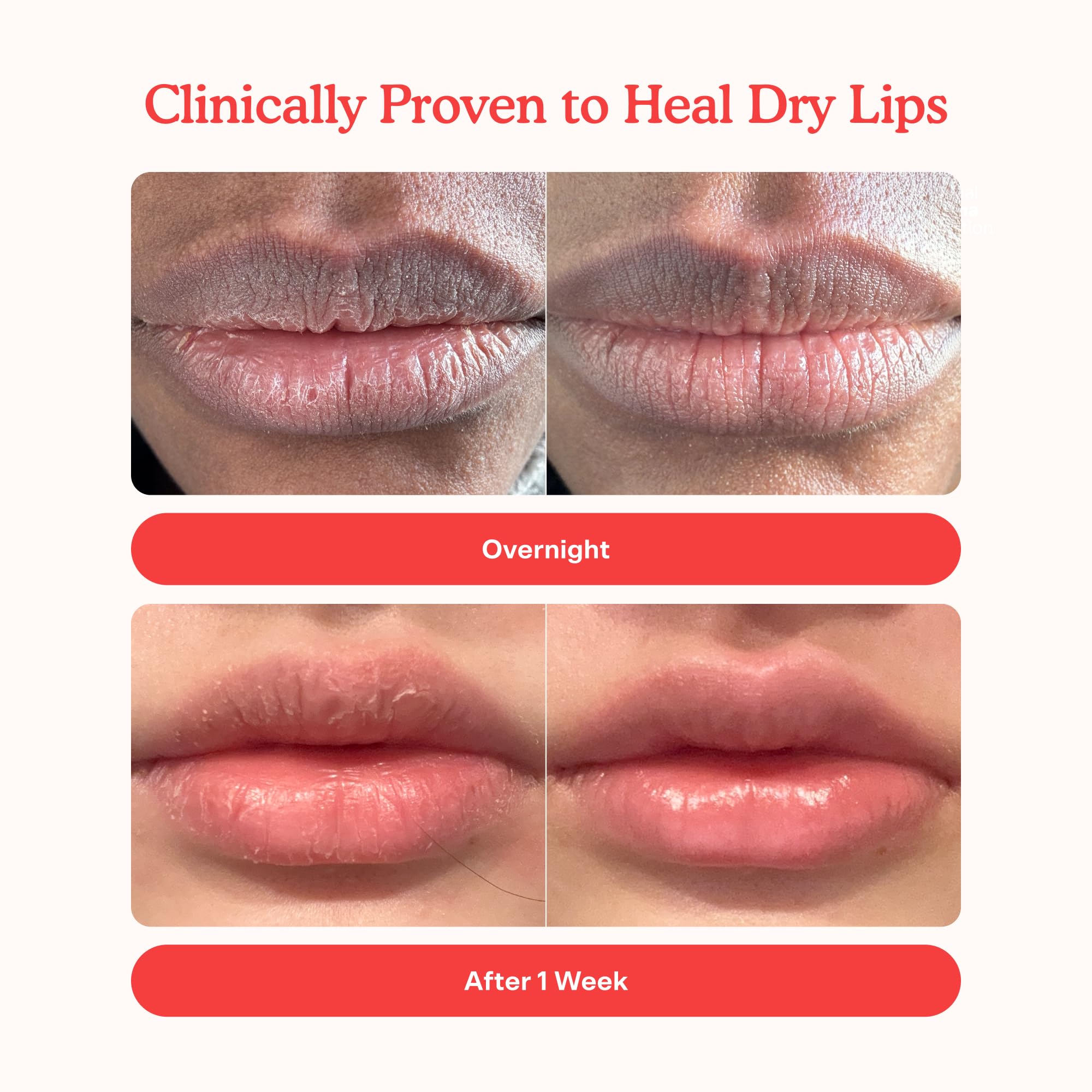 Tower 28 LipSoftie Tinted Lip Balm Treatment – Hydrating Glossy Balm + Overnight Lip Mask, SOS Vanilla