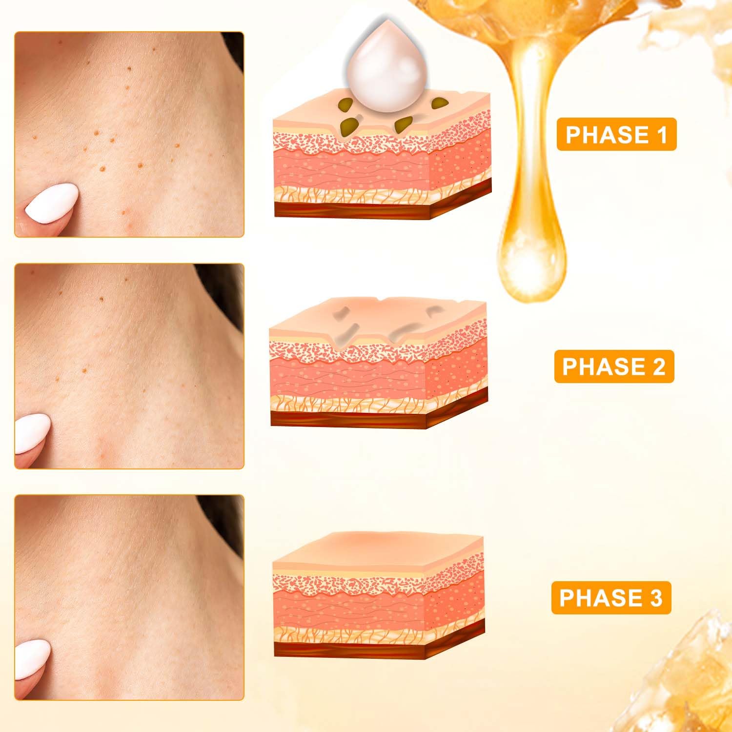 Traboto Bee Venom Cream (2 Pcs) – Professional Skin Care for Neck, Back, Hands, Feet