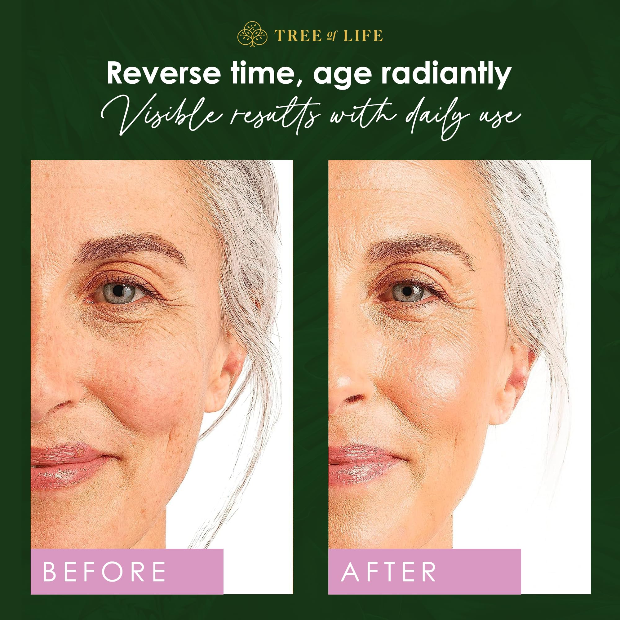 Tree of Life Beauty Retinol Serum with Hyaluronic Acid – Skin Smoothing Face Oil (2 x 2 oz)