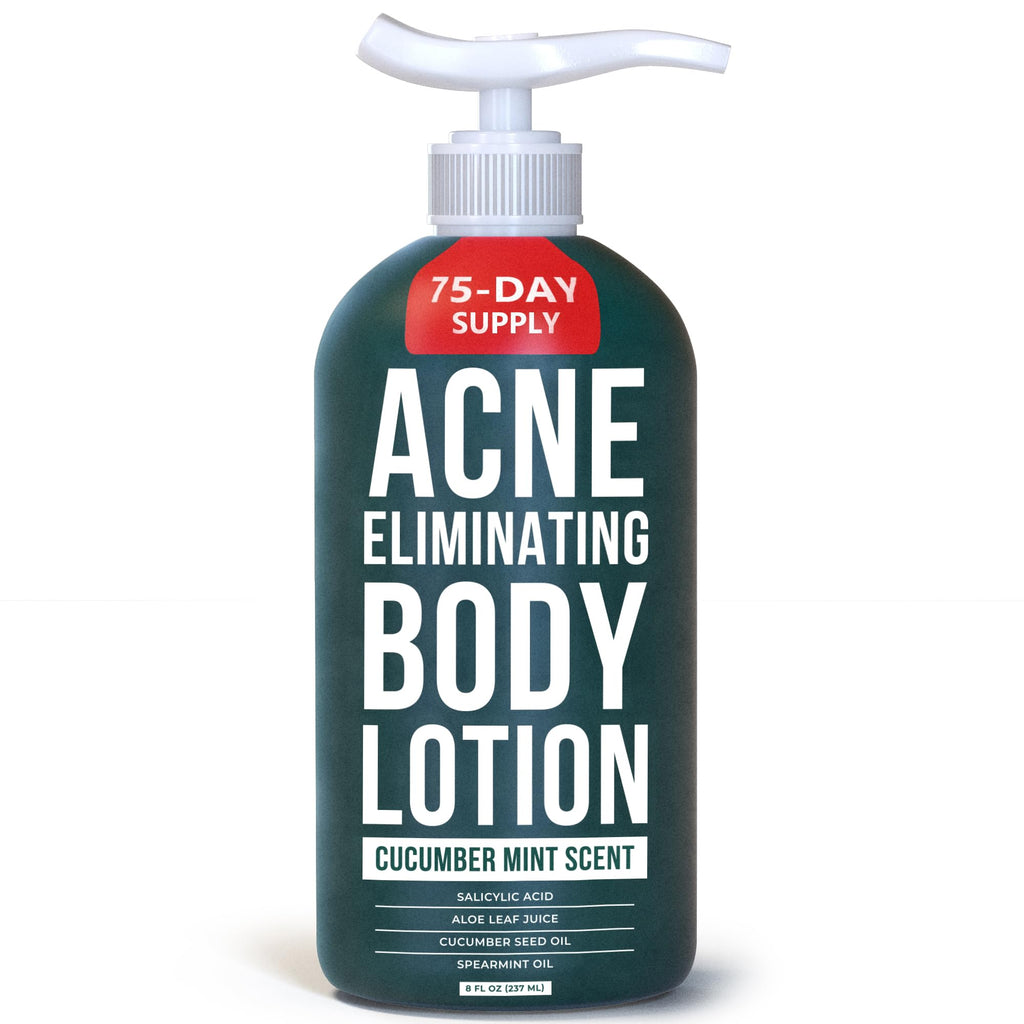 TreeActiv Acne Eliminating Body Lotion 8 oz | Clears Body, Back, Butt & Shoulders | Cucumber Mint