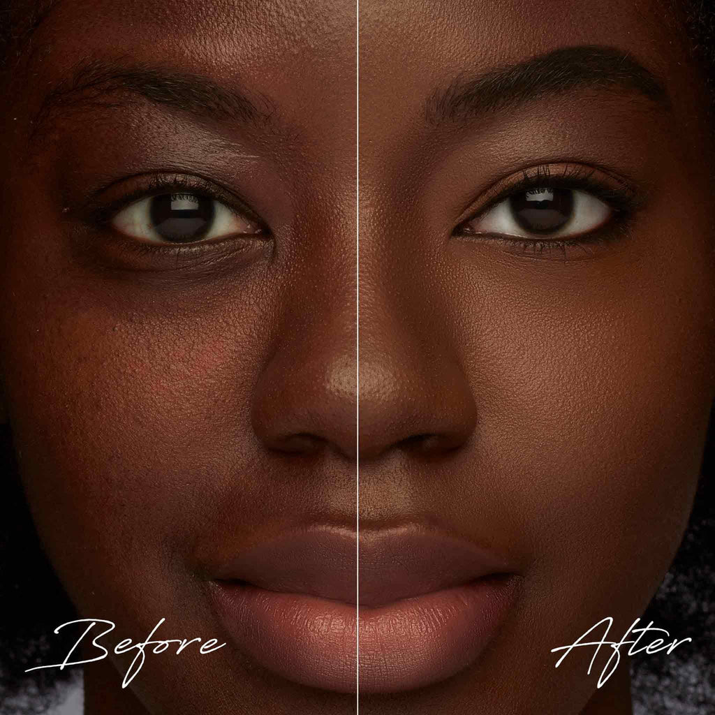 TRE'STIQUE Concealer Crayon – Refillable Under Eye Concealer with Built-In Sponge