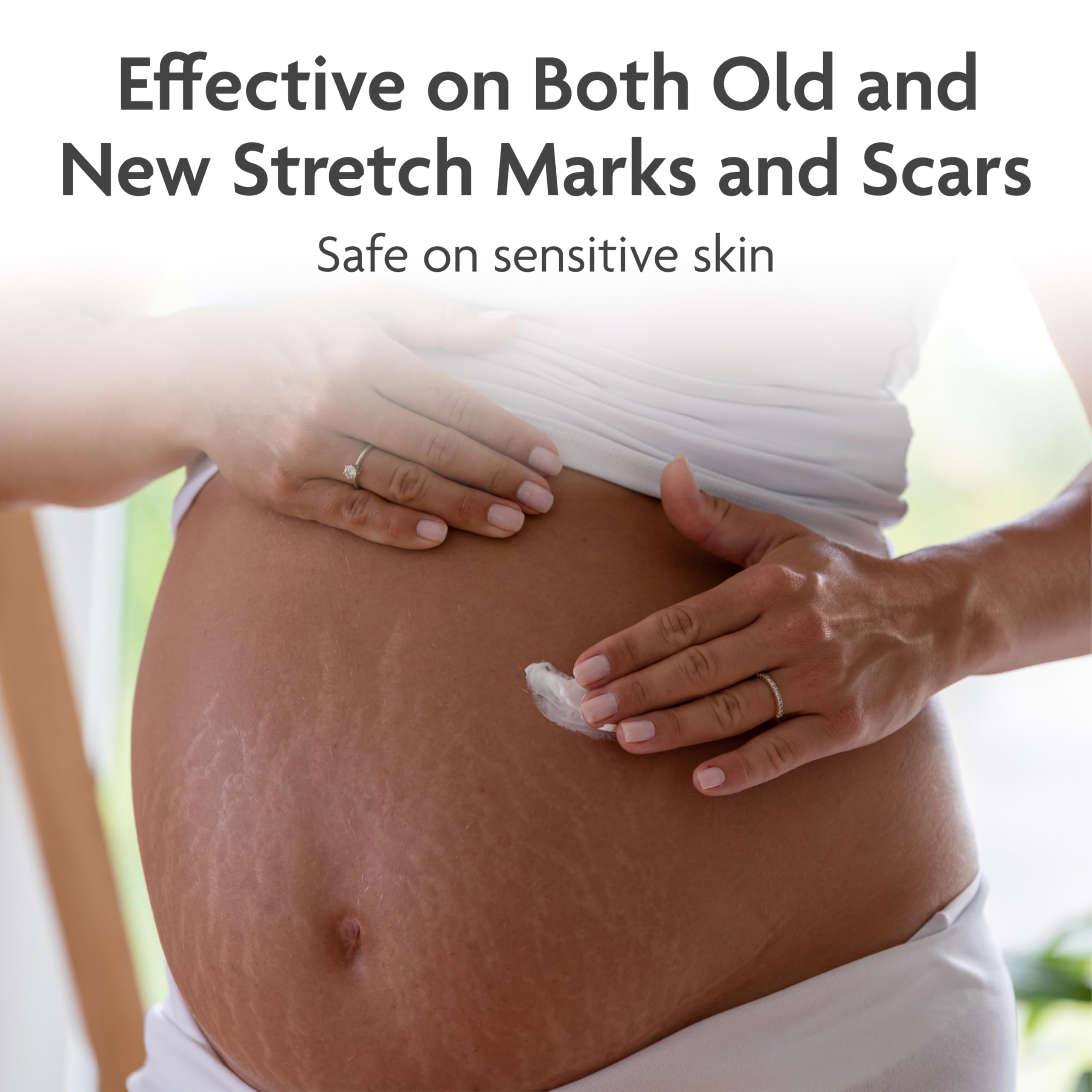 TriLASTIN Stretch Mark Cream — Collagen-Boosting Maternity Lotion (5.5 oz, Unscented, Paraben-Free)