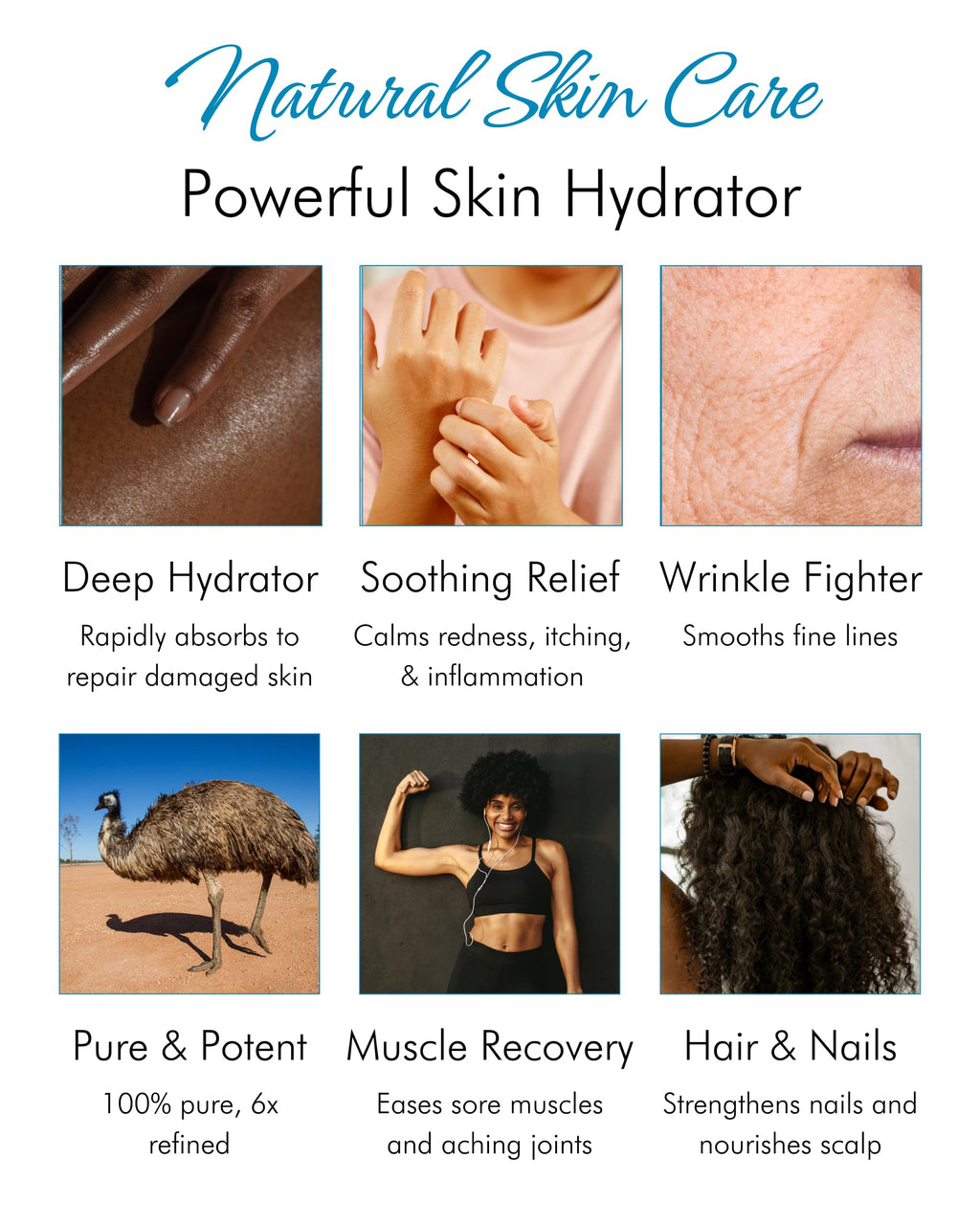 Tropical Holistic 100% Pure Australian Emu Oil 4 oz – Premium Undiluted Moisturizer for Skin, Hair, Nails