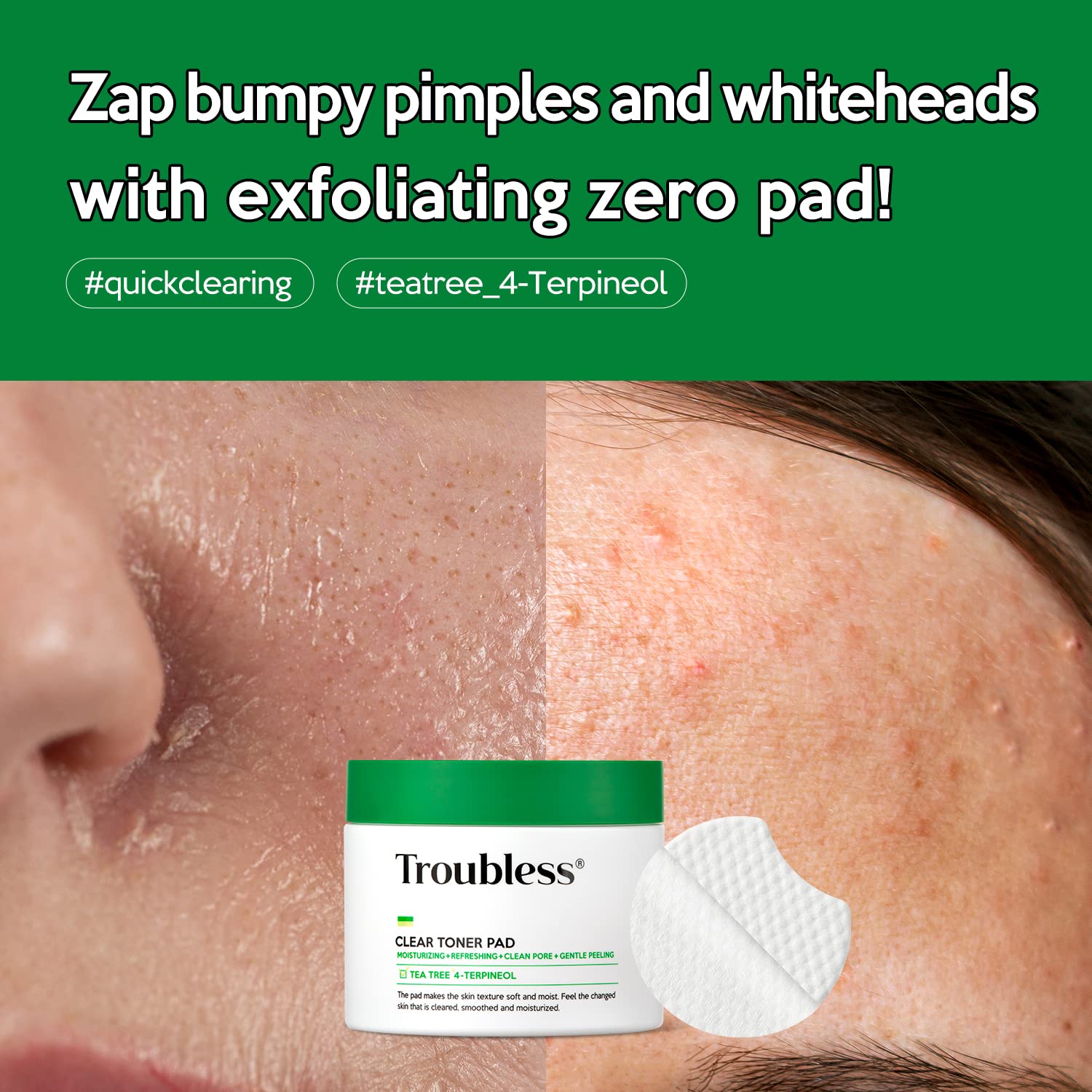 Troubless Clear Toner Pad for Face | Gentle Peeling & Soothing Tea Tree, 60 Pads