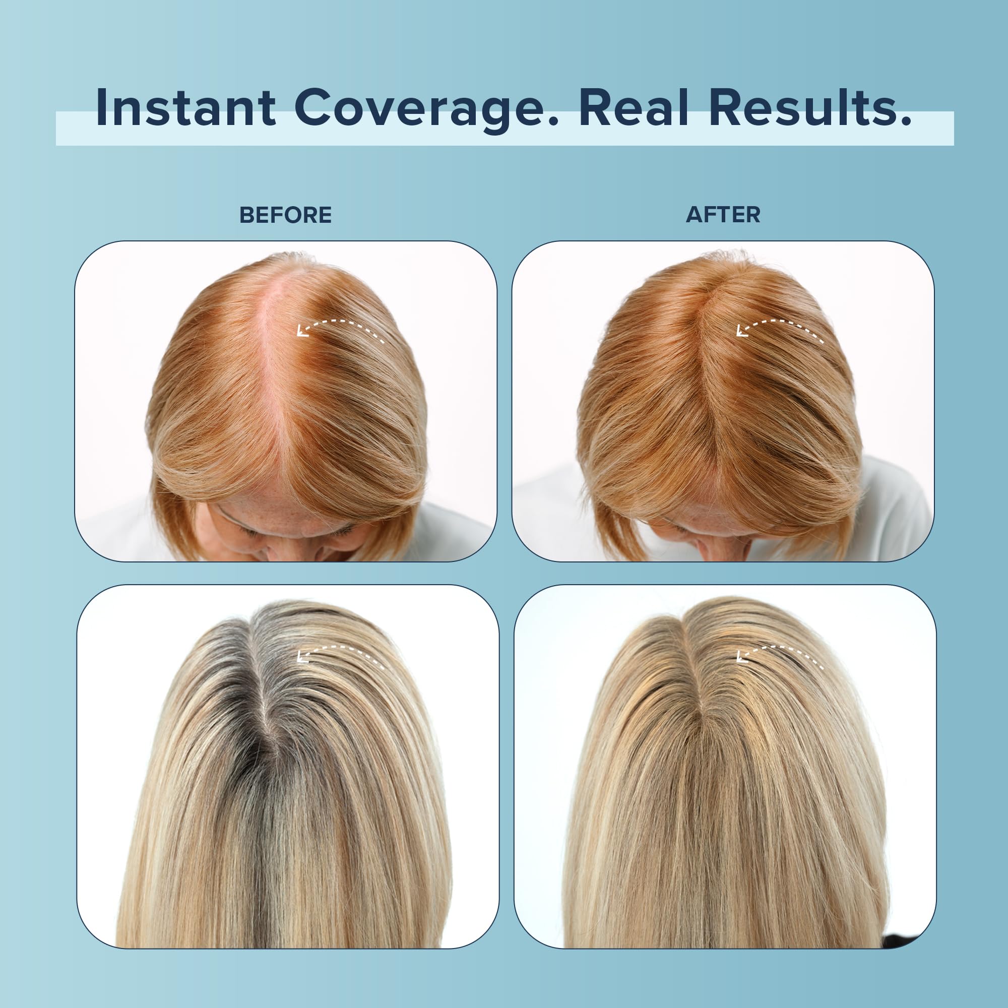 TRUHAIR Color Fibers Root Coverage & Density Booster | Quick-Apply Touch Up Hair Color | 11 Shades Available (Blonde)