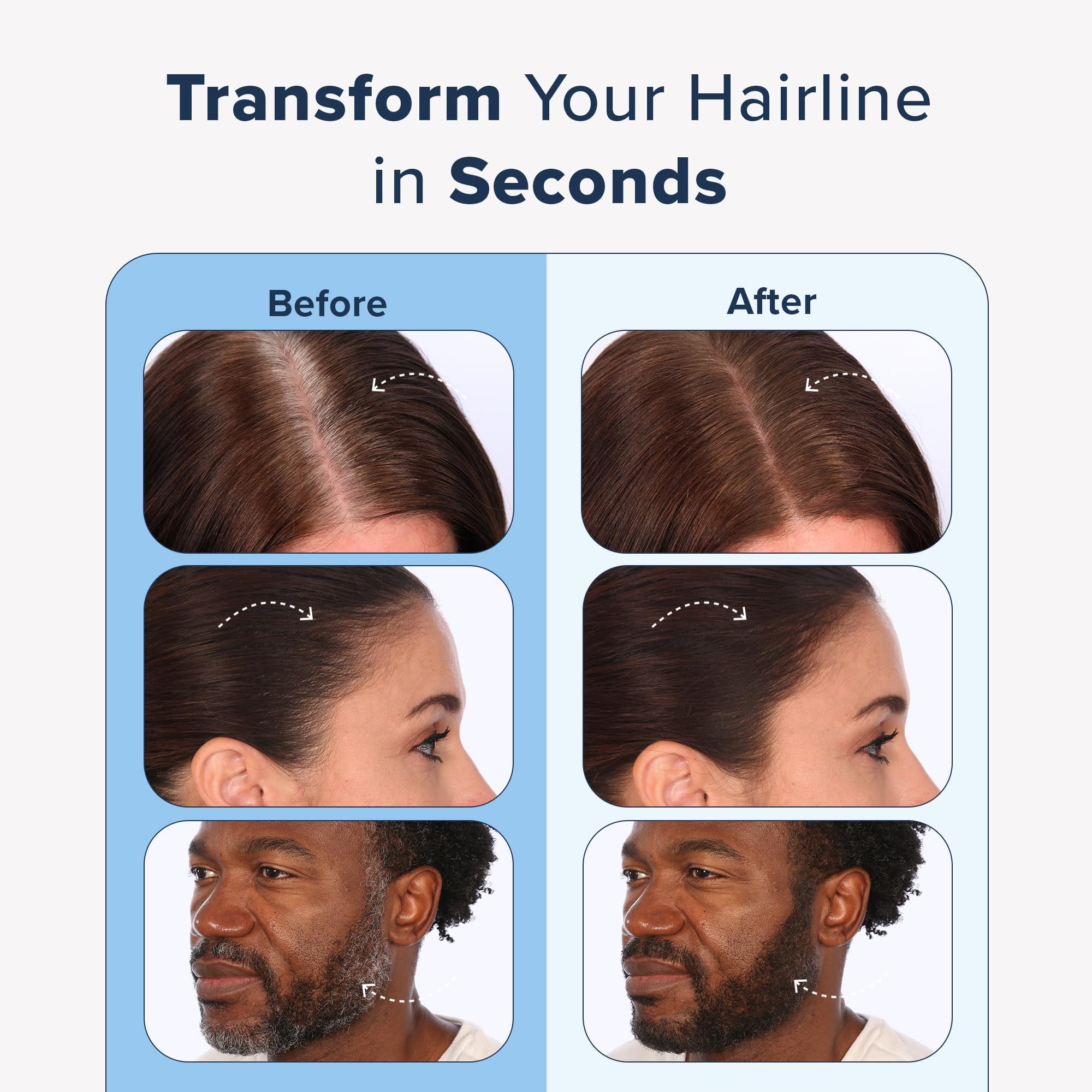 TRUHAIR Jumbo Color & Conceal — Waterproof Root Touch Up for Gray Hair