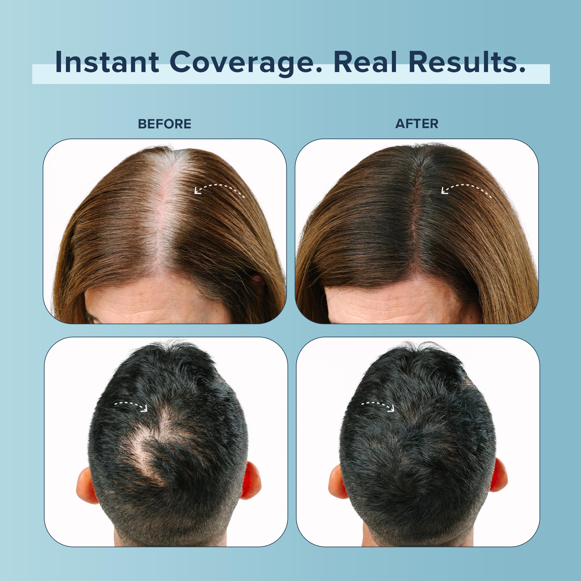 TRUHAIR Color Fibers Root Coverage & Density Booster | Quick-Apply Touch Up Hair Color | 11 Shades Available (Blonde)