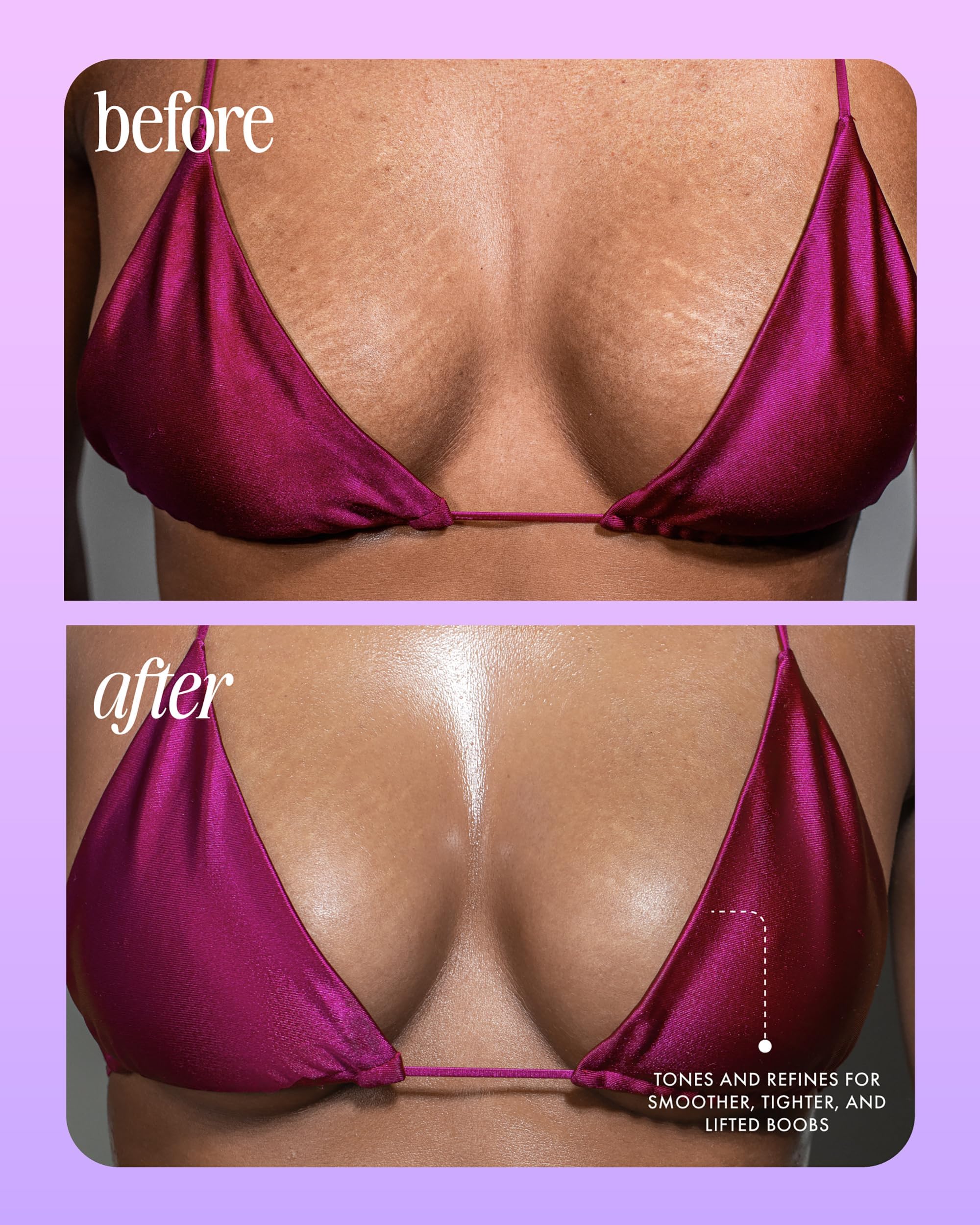 Truly Beauty Acai Your Boobies Serum – Bust Firming, Skin Elasticity, 3.1 oz