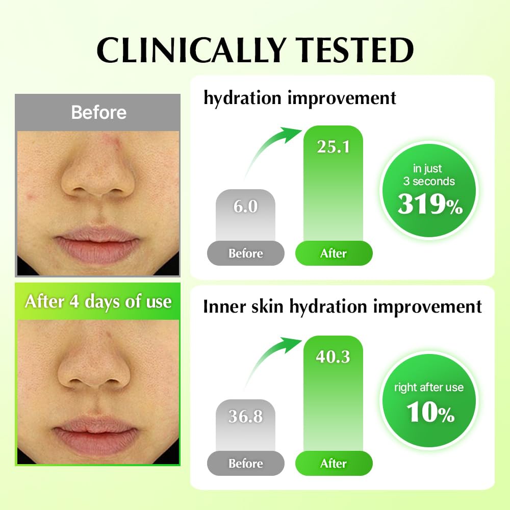 UIQ Biome Remedy Soothing Cream – Instant Hydration, Panthenol, Non-Comedogenic, 50ml (Korean Skincare)