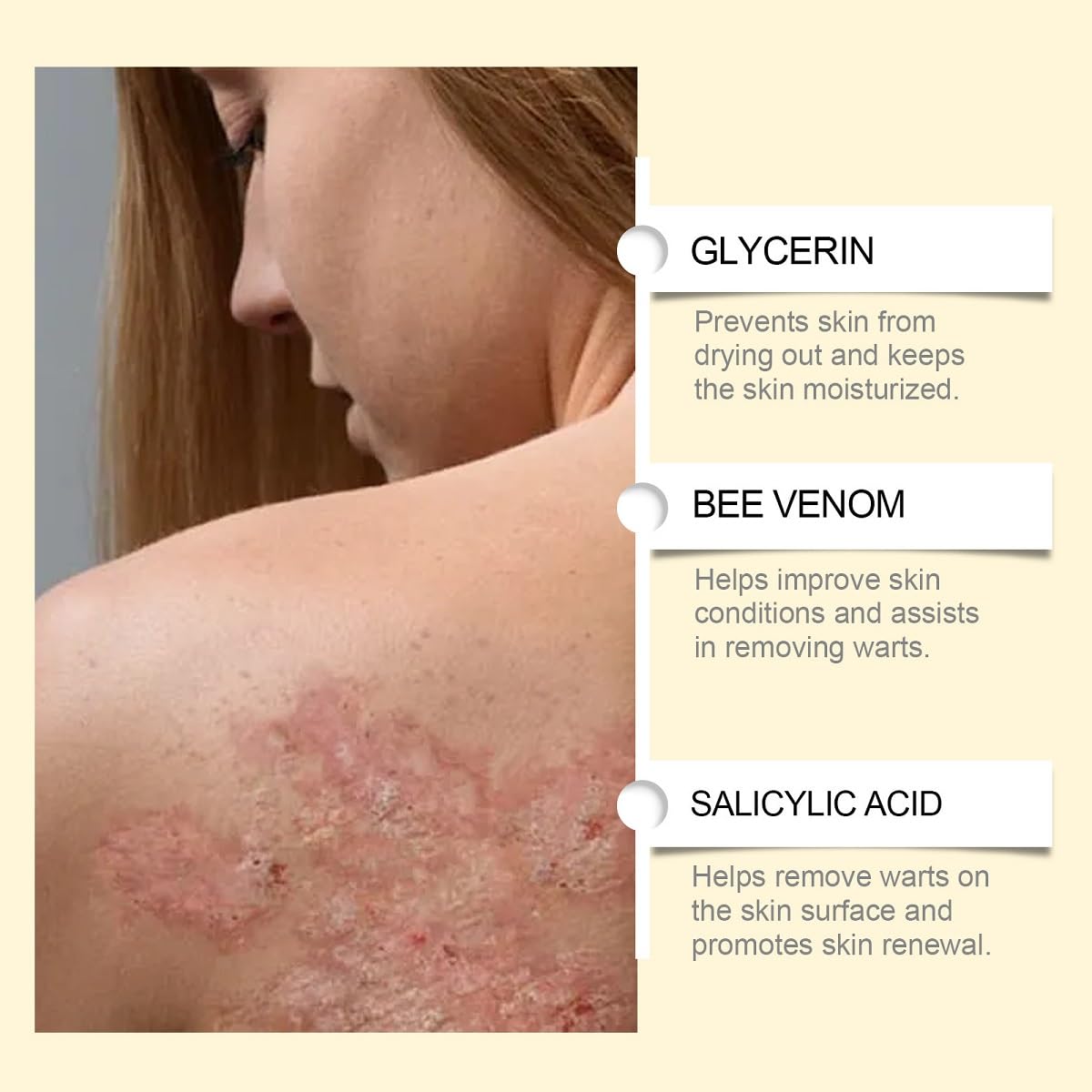 UKDVRL Bee Venom Skin Treatment Cream – Hydrating, Firming & Anti-Aging Moisturizer