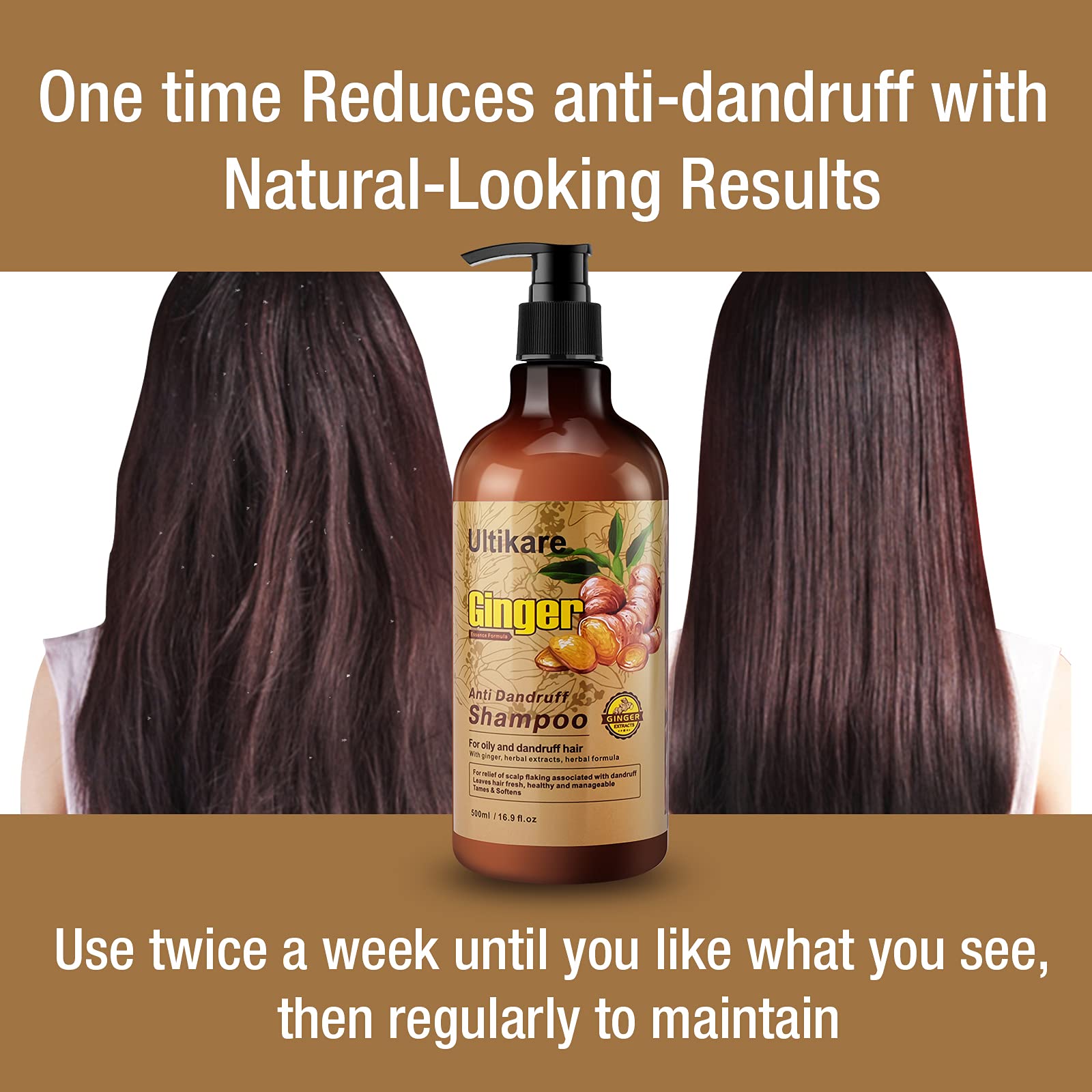 Ultikare Ginger Shampoo for Dandruff – Anti-Dandruff Scalp Care for Itchy Dry Scalp