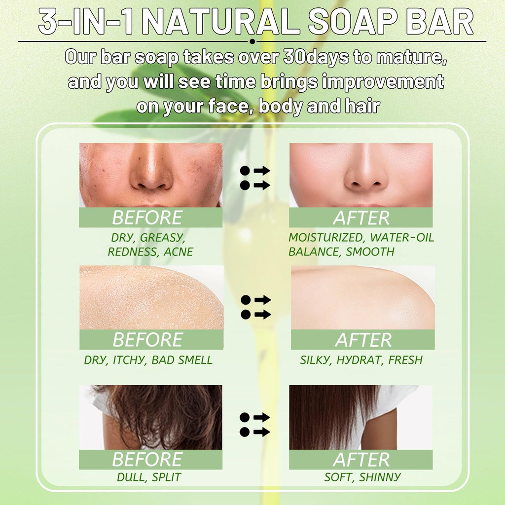 Umpeimvon 5 Pack Olive Oil Soap Bar – 80% Olive Oil, 20% Laurel, Cold-Pressed & Fragrance-Free