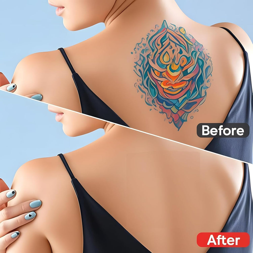 Tattoo Cover Up Patch Kit — 15 Patches + 15 Remover Stickers, Water-Resistant, Ultra-Thin Concealer