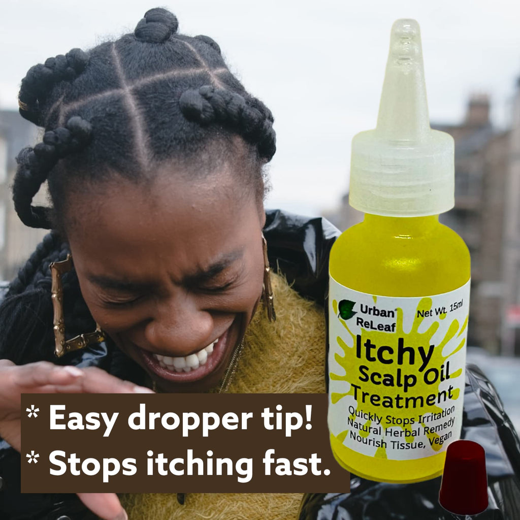 Urban ReLeaf Itchy Scalp Oil Treatment – Pack of 2 for Braids, Wigs & Tight Hairstyles – Made in USA