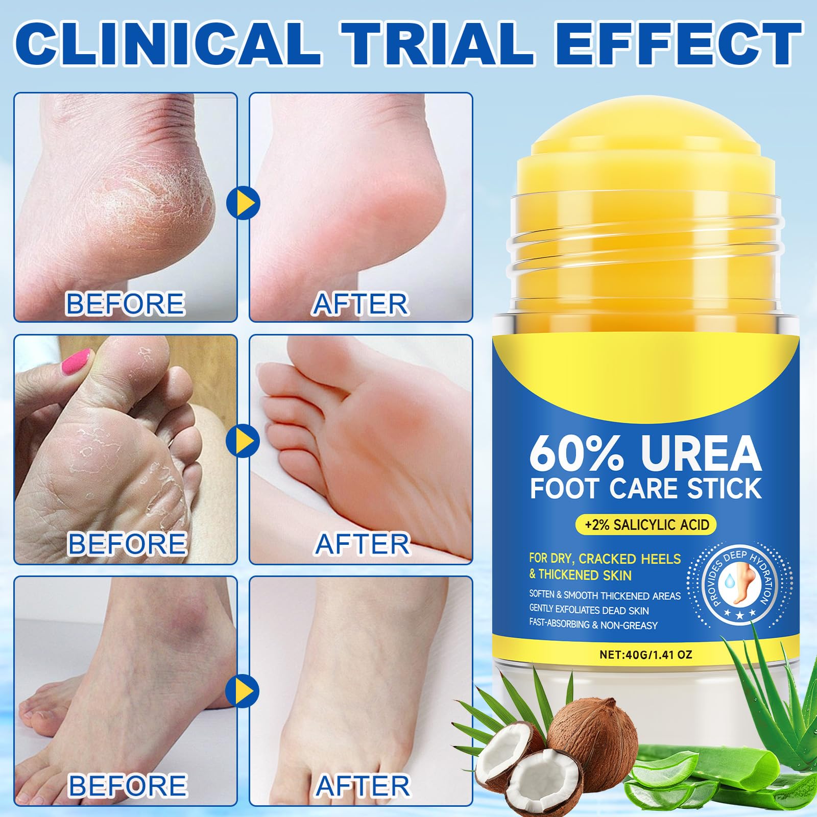 60% Urea Foot Care Stick with 2% Salicylic Acid – Deep Moisture & Gentle Exfoliation, 1.41 oz