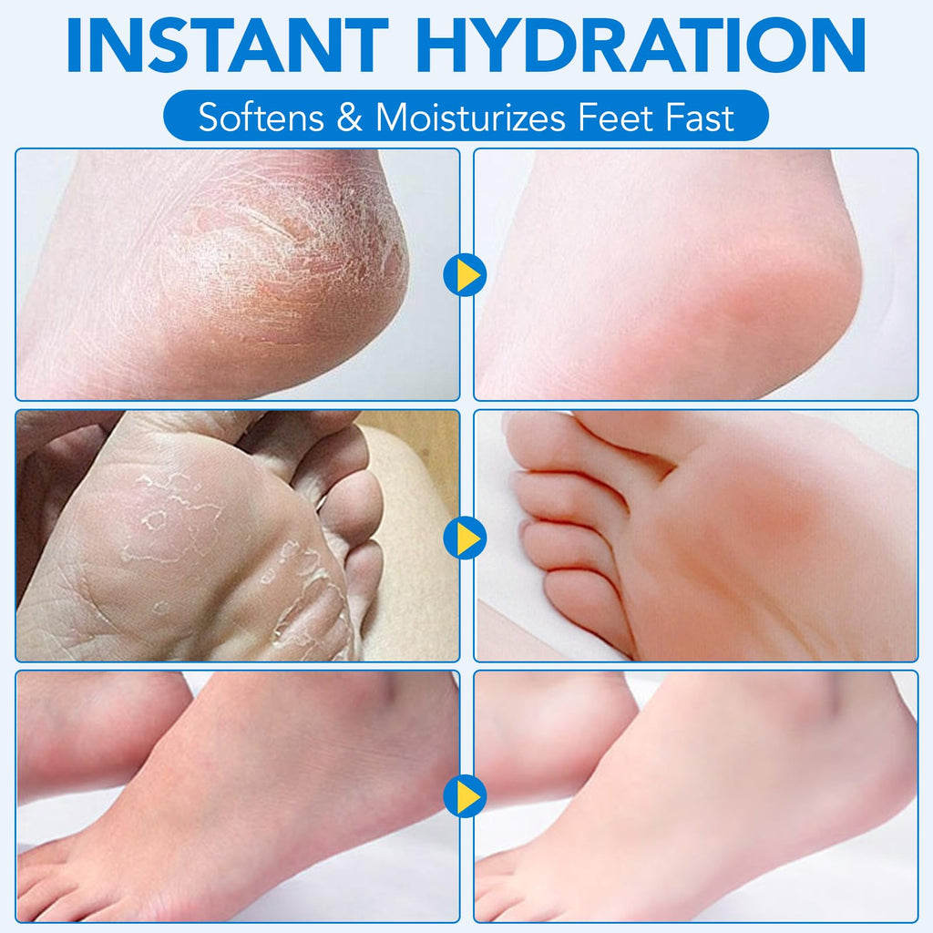 Uruses 2Pack Urea Cream 60% + Salicylic Acid 2% Foot Care Stick – Hydrating Heel Balm