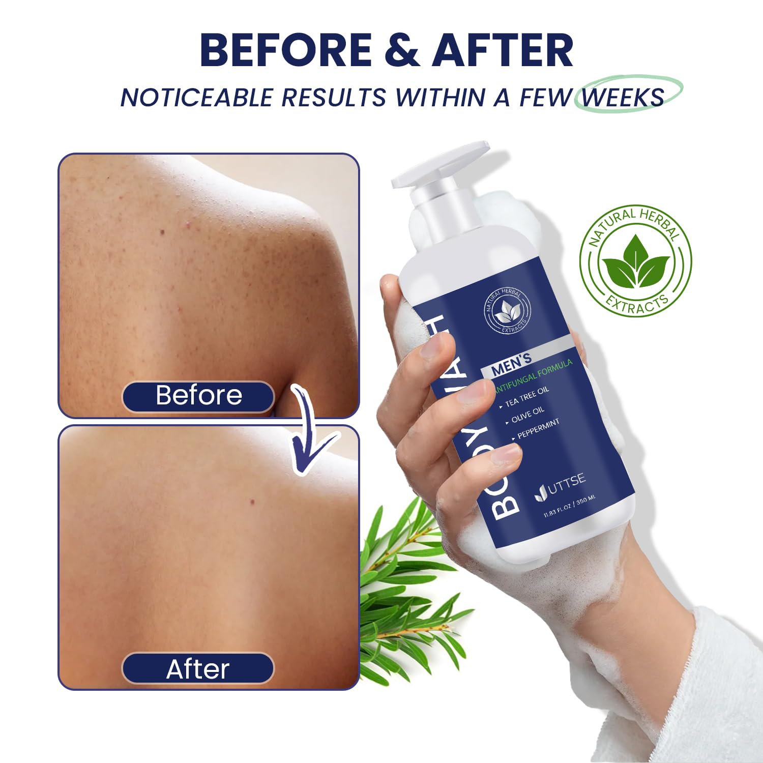 Uttse Tea Tree Body Wash for Men — Antifungal Cleanser, Odor Control & Skin Comfort (11.8 oz / 350 mL)