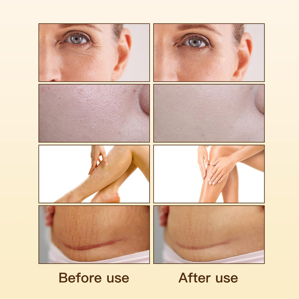 UWPU Frankincense Oil for Face – Bakuchiol & Squalane Gentle Facial Oil for All Skin Types