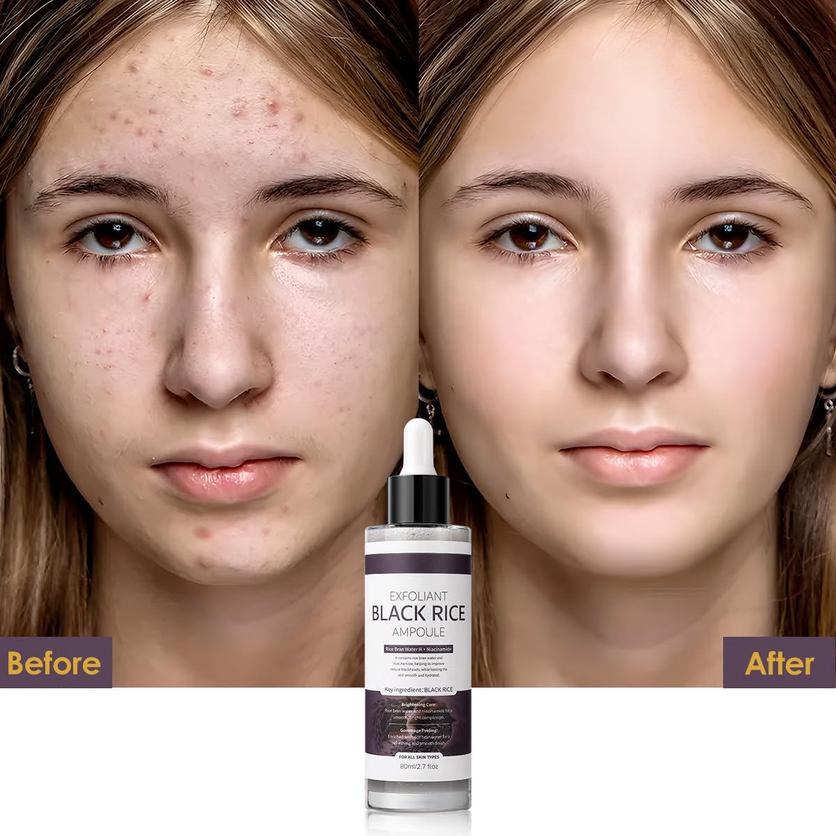 Veakoo Peel Shot Glow Black Rice Exfoliant Ampoule – Gentle Exfoliating Brightening Serum, 80ml