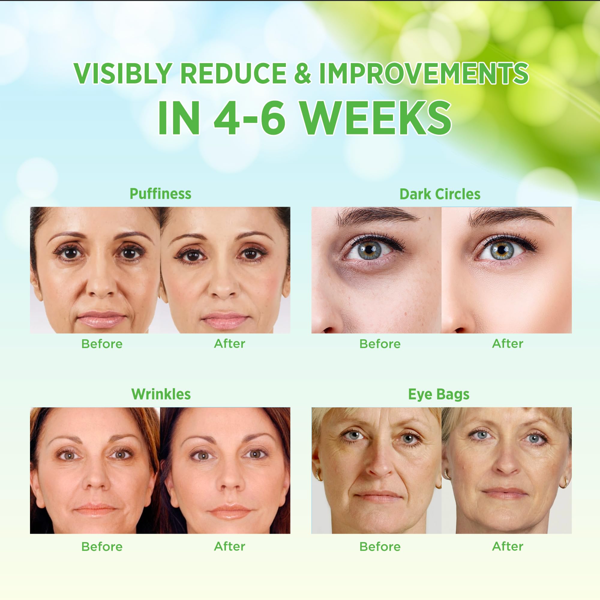 VELAMO ADVANCED Under Eye Patches – Aloe Vera, Retinol & 24k Gold for Puffiness, Dark Circles, and Wrinkles | 60 Pcs