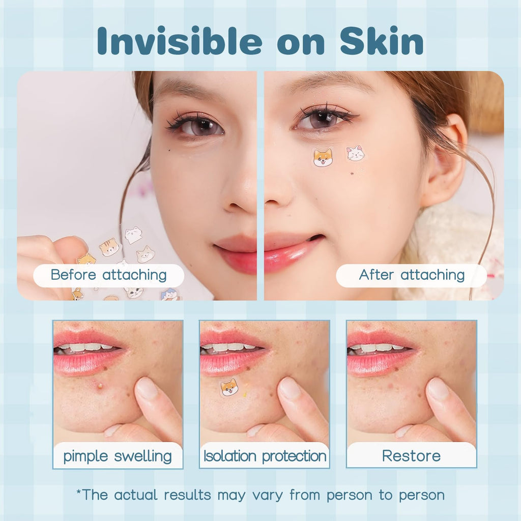 Venrock Pimple Patches — 48 Hydrocolloid Patches in 24 Cute Animal Shapes