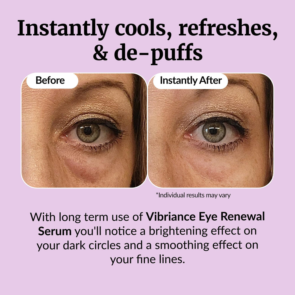 Vibriance Eye Renewal Serum – Dark Circles & Puffiness Reduction (Caffeine Formula)