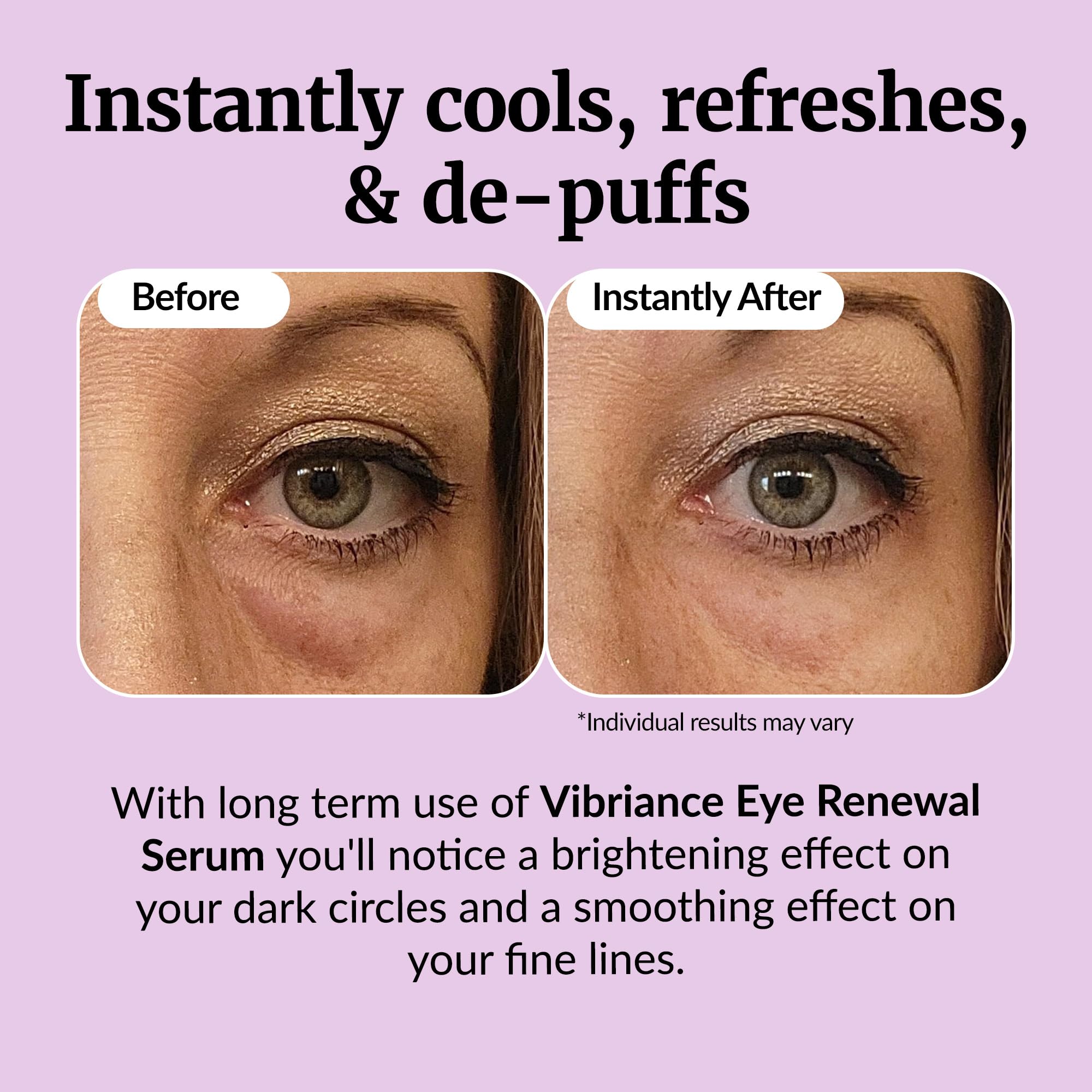 Vibriance Eye Renewal Serum – Dark Circles & Puffiness Reduction (Caffeine Formula)