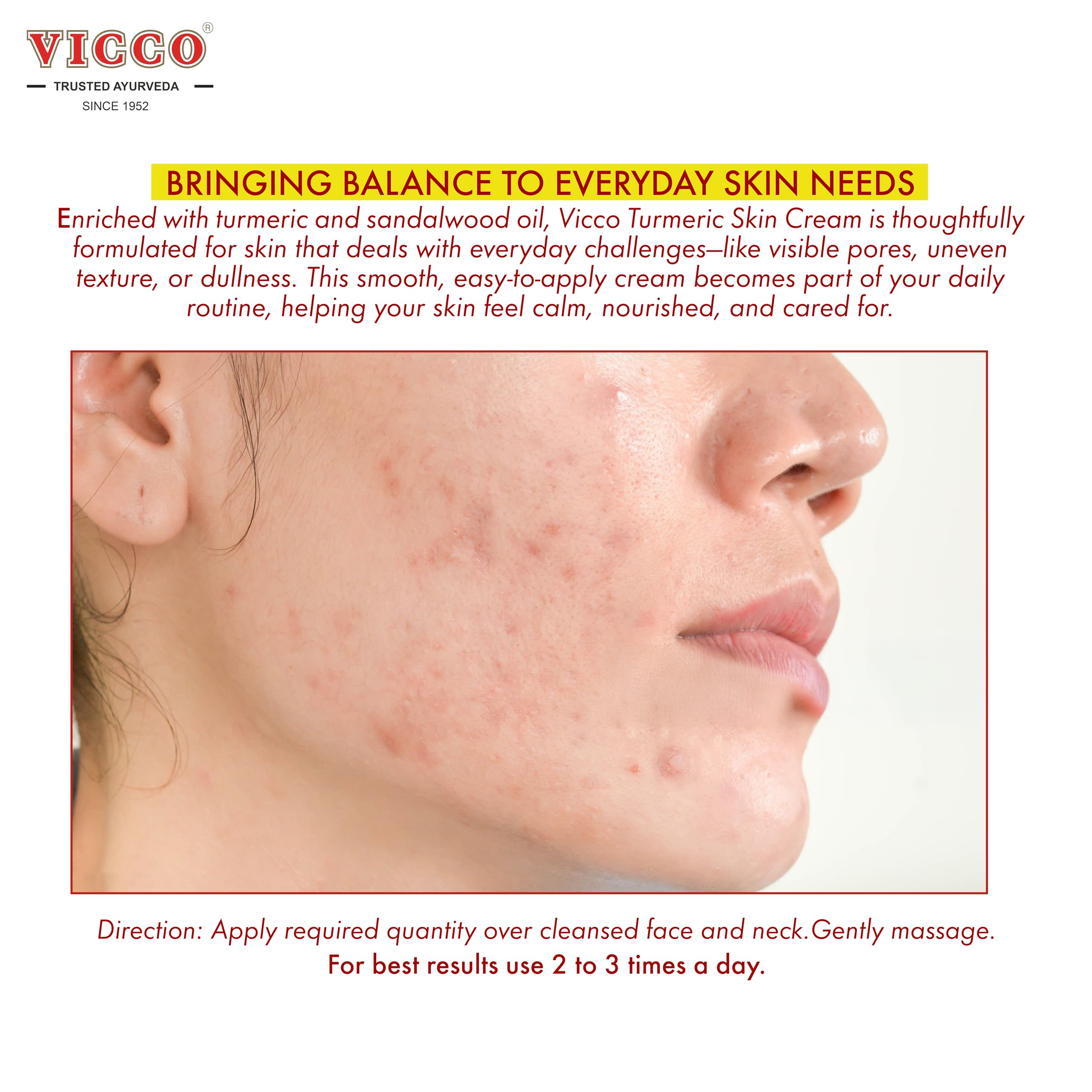 Vicco Turmeric Face Moisturizer Cream with Sandalwood Oil – 70-Year Ayurveda Legacy, Hydrating Natural Turmeric, Vegan, 3 x 2.82 oz