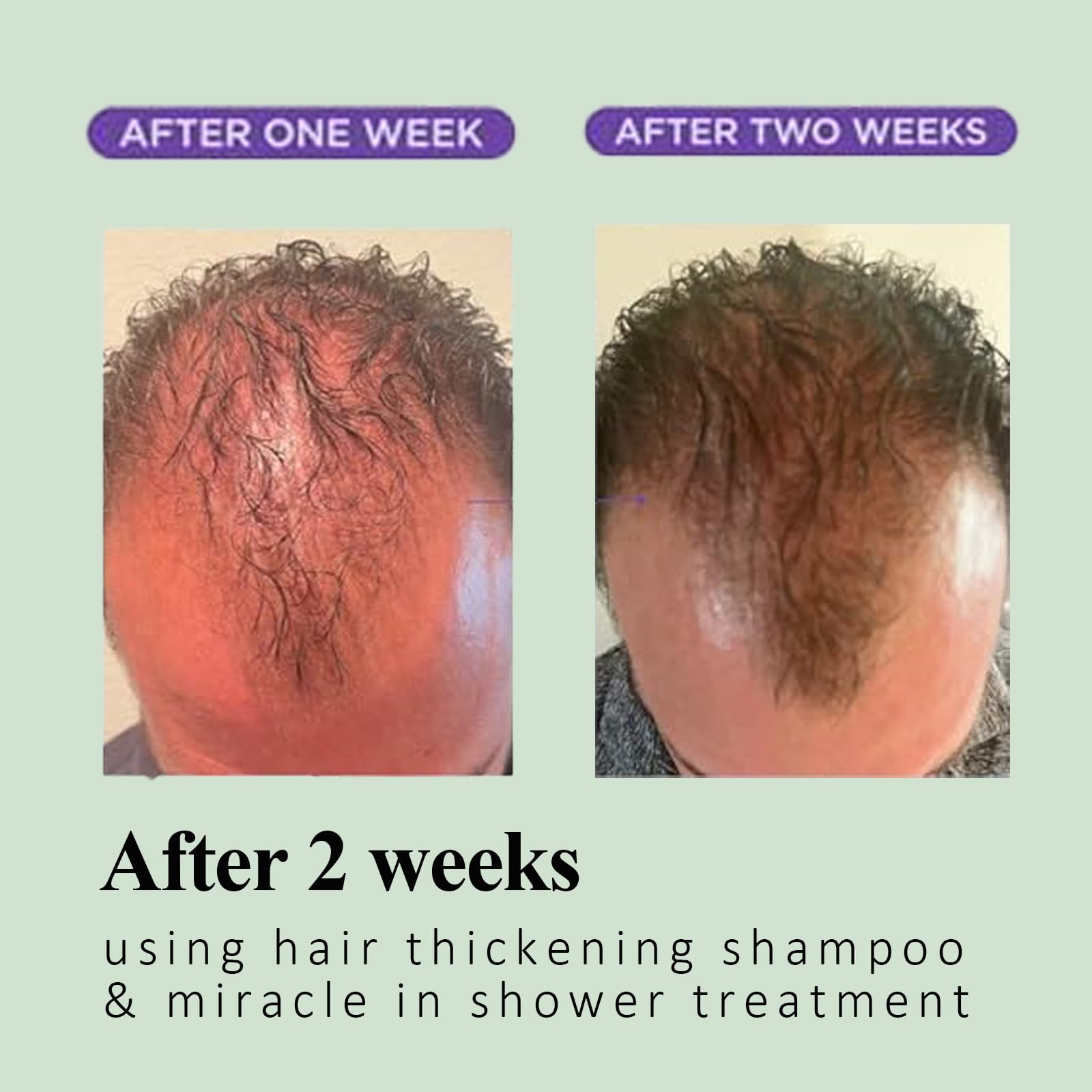 Vimchaw Rosemary Hair Growth Shampoo – Natural Thickening for Thinning Hair (3.4 oz)
