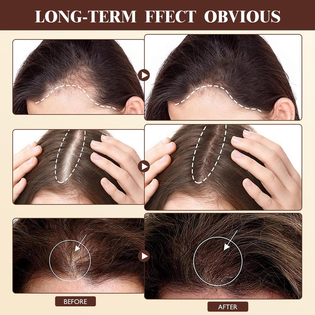 Vincofoo 2PC Hair Growth Spray – Natural Anti-Hair Loss for Thinning Hair