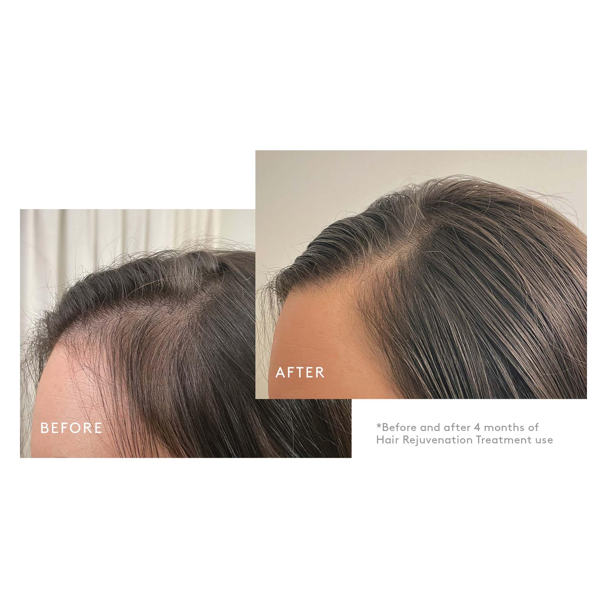 Virtue Flourish 3-Step Hair Care Bundle for Thinning Hair – Drug-Free Regimen