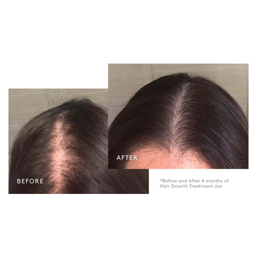 Virtue Flourish Hair Growth Regimen for Women | Minoxidil 5% Foam, Sulfate-Free & Color-Safe