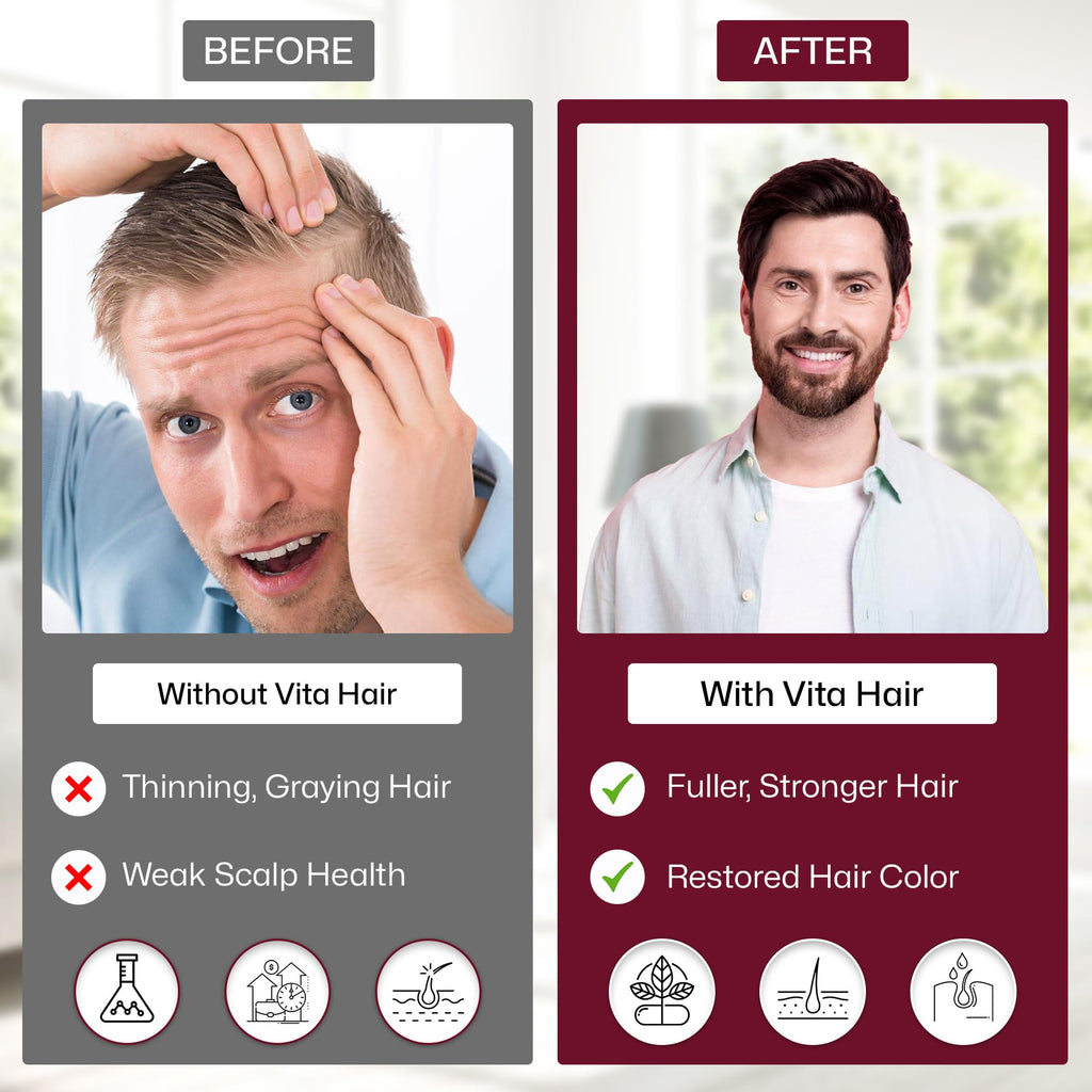 Vita Hair Micronized Formula – Natural Growth & Hair Loss Support | Vita Green – 300 Capsules