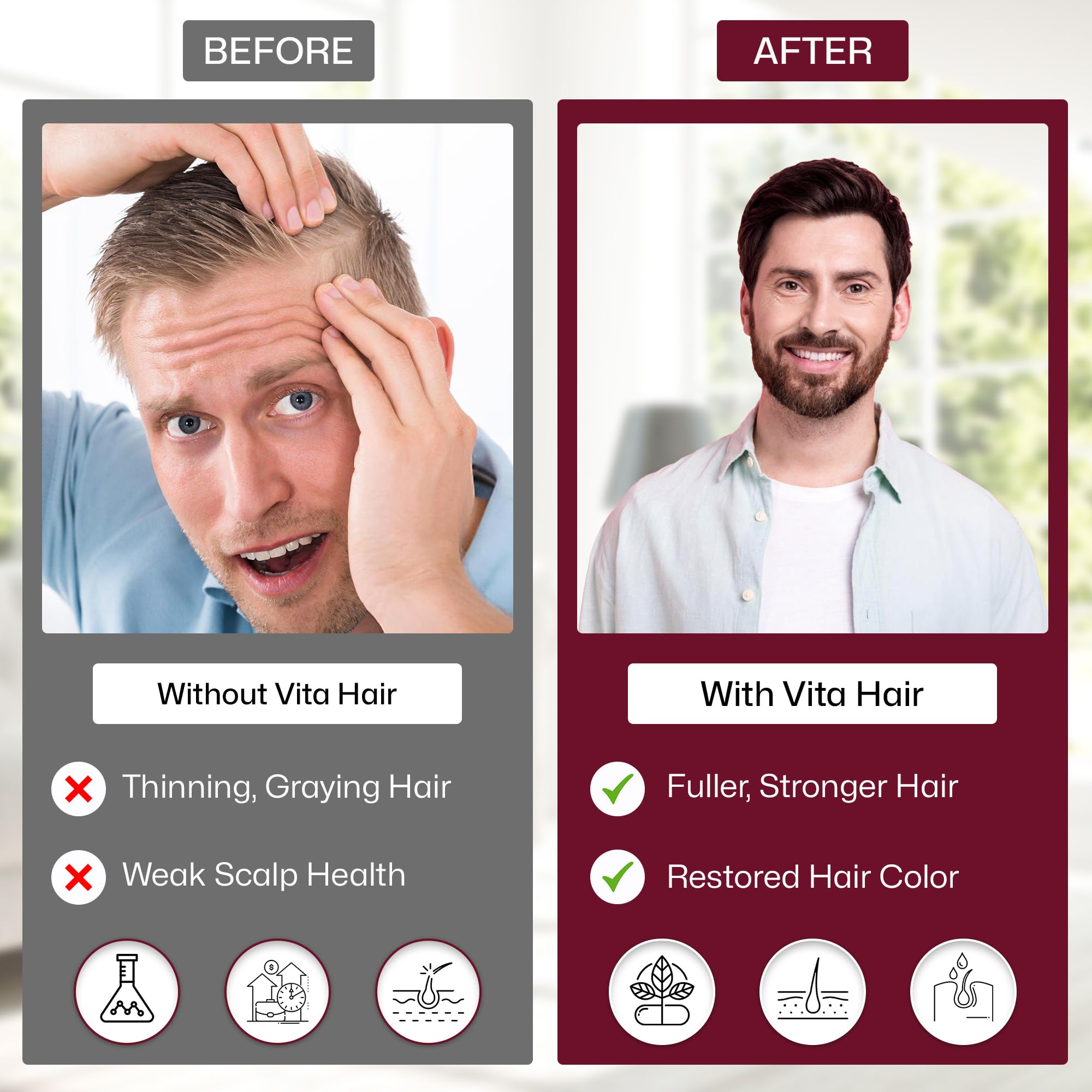 Vita Hair Micronized Formula – Natural Growth & Hair Loss Support | Vita Green – 300 Capsules
