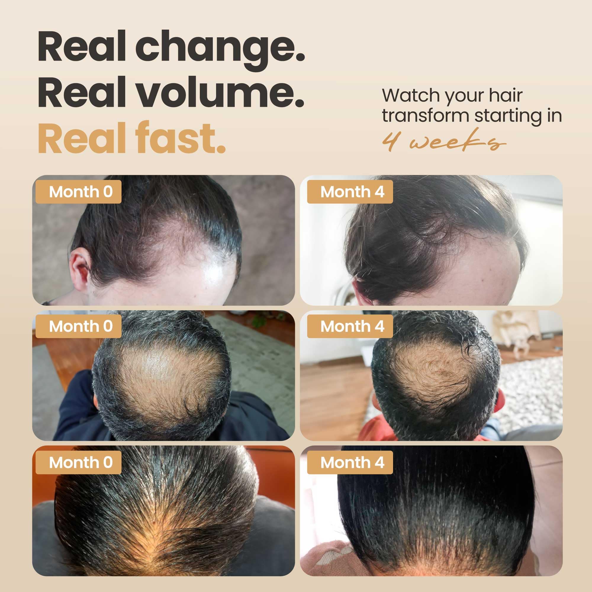 Vitasei Hair Booster: Peptide Serum for Thicker, Stronger Hair