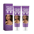 Vitiligo Cream – Natural Skin Pigmentation Support (2-Pack)